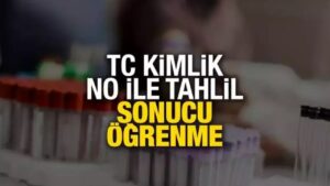 T.C. Kimlik No ile Tahlil Sonucu Öğrenme (E-Devlet, E-Nabız, MHRS)
